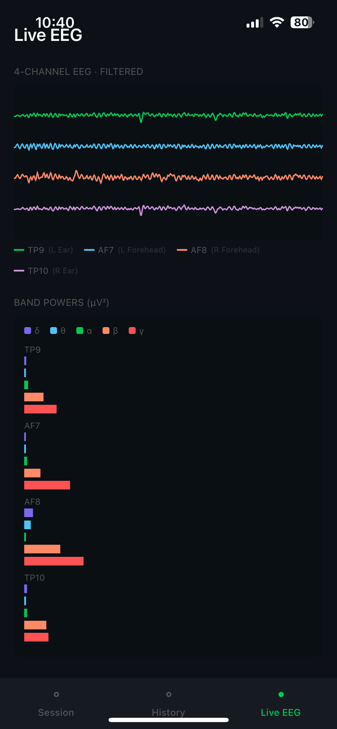 Live EEG waveform display